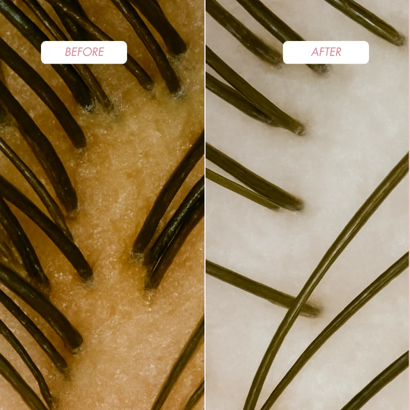 ProHair Trychologiczne Trio 3w1 – Peeling, Szampon i Maska z Keratyną i Imbirem - Image 18